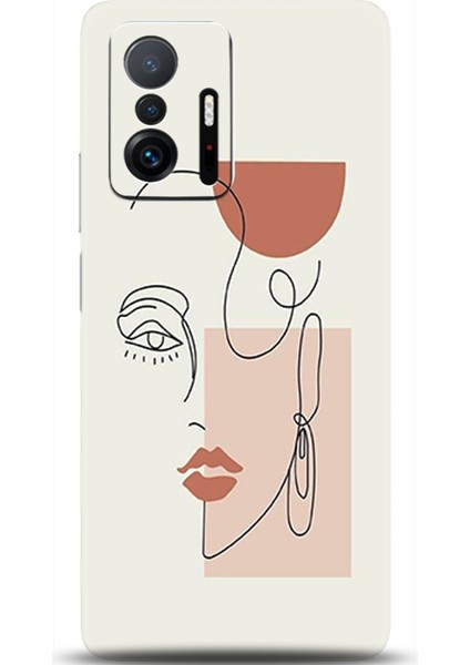 Xiaomi Mi 11T Kılıf Hd Baskılı Kılıf - Followed Institution 0172