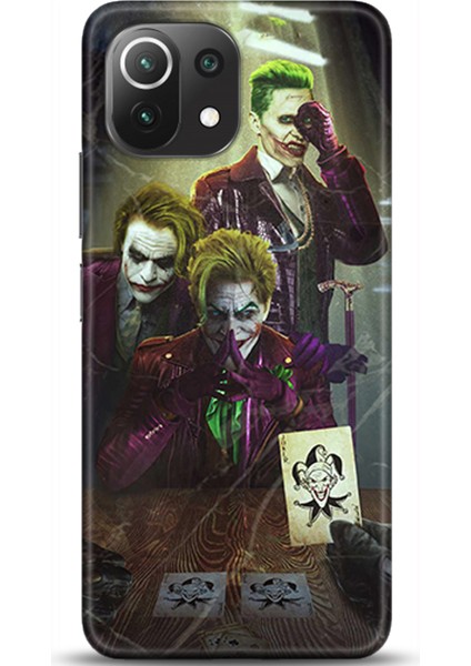 Xiaomi Mi 11 Lite Kılıf Hd Baskılı Kılıf - Followed Institution 0508