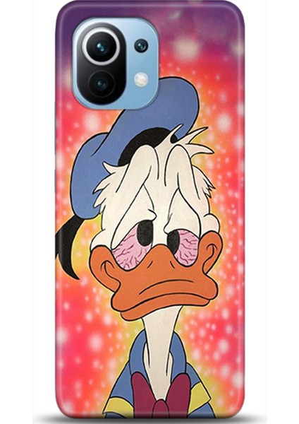 Xiaomi Mi 11 Kılıf Hd Baskılı Kılıf - Followed Institution 0288