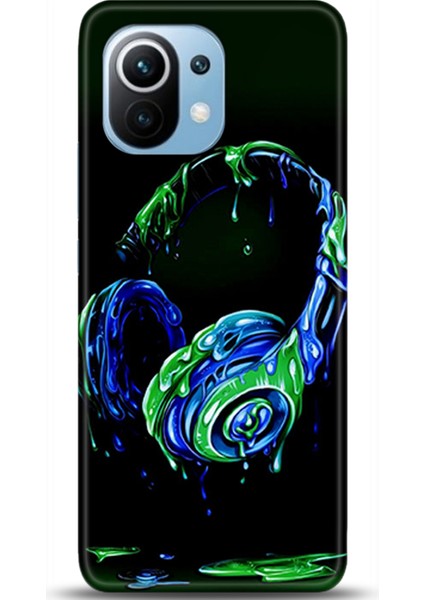 Xiaomi Mi 11 Kılıf Hd Baskılı Kılıf - Followed Institution 0455