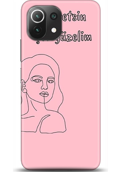 Xiaomi Mi 11 Lite Kılıf Hd Baskılı Kılıf - Followed Institution 0074