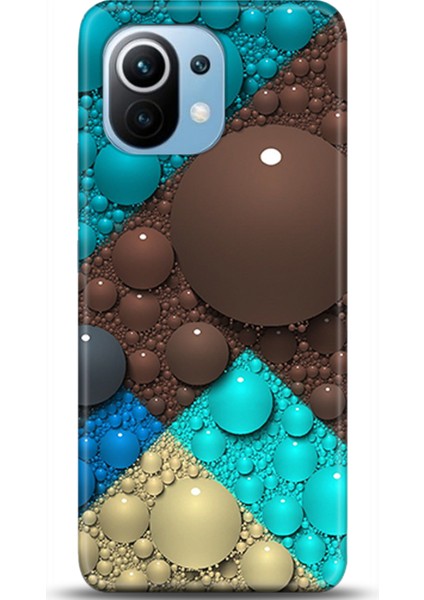 Xiaomi Mi 11 Kılıf Hd Baskılı Kılıf - Followed Institution 0486