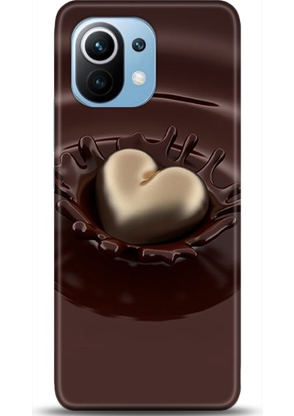 Xiaomi Mi 11 Kılıf Hd Baskılı Kılıf - Followed Institution 0699