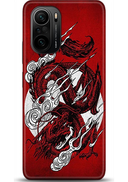 Xiaomi Mi 11i Kılıf Hd Baskılı Kılıf - Followed Institution 0145