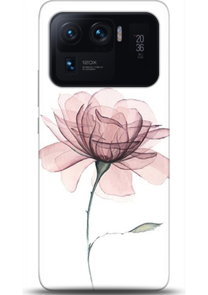 Xiaomi Mi 11 Ultra Kılıf Hd Baskılı Kılıf - Followed Institution 0309