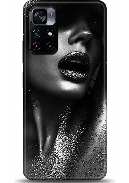 Xiaomi Poco M4 Pro 5g Kılıf Hd Baskılı Kılıf - Followed Institution 0338
