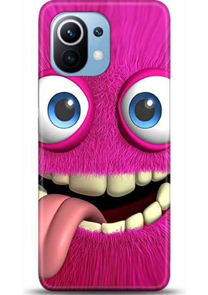 Xiaomi Mi 11 Kılıf Hd Baskılı Kılıf - Followed Institution 0013