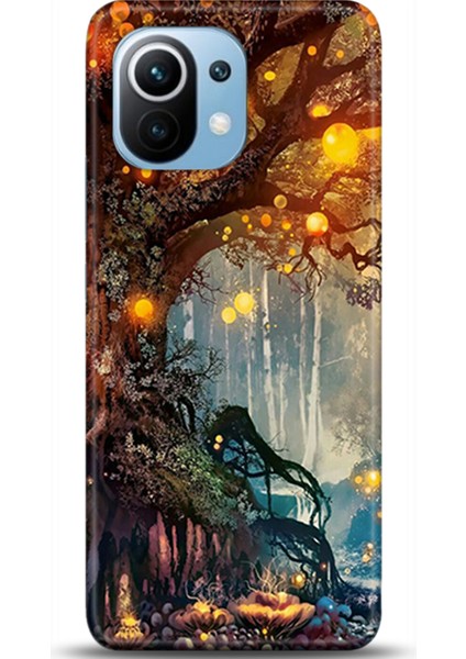 Xiaomi Mi 11 Kılıf Hd Baskılı Kılıf - Followed Institution 0135