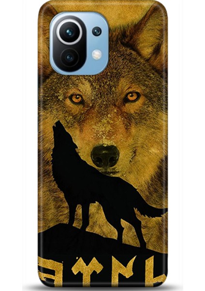 Xiaomi Mi 11 Kılıf Hd Baskılı Kılıf - Followed Institution 0154