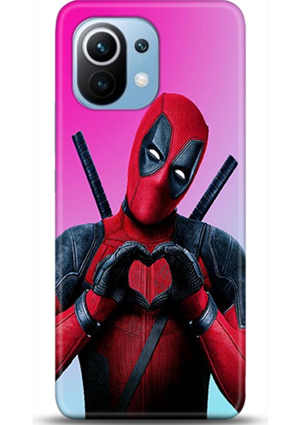 Xiaomi Mi 11 Kılıf Hd Baskılı Kılıf - Followed Institution 0218