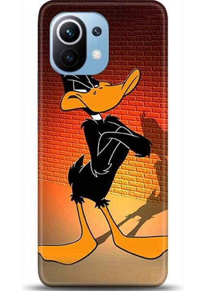 Xiaomi Mi 11 Kılıf Hd Baskılı Kılıf - Followed Institution 0260