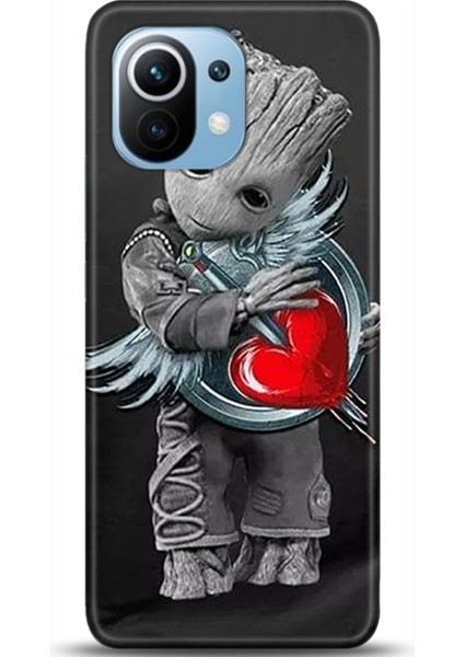 Xiaomi Mi 11 Kılıf Hd Baskılı Kılıf - Followed Institution 0282