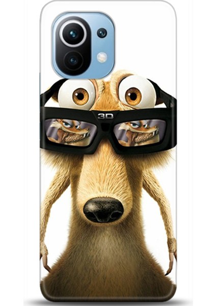Xiaomi Mi 11 Kılıf Hd Baskılı Kılıf - Followed Institution 0330