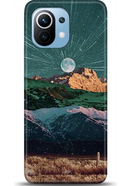 Xiaomi Mi 11 Kılıf Hd Baskılı Kılıf - Followed Institution 0332