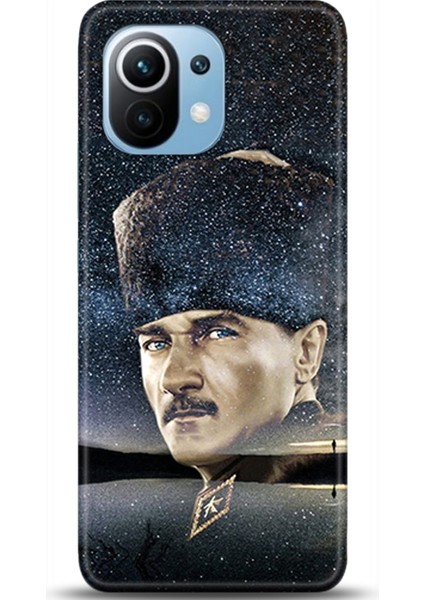 Xiaomi Mi 11 Kılıf Hd Baskılı Kılıf - Followed Institution 0404