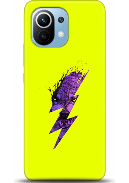 Xiaomi Mi 11 Kılıf Hd Baskılı Kılıf - Followed Institution 0497