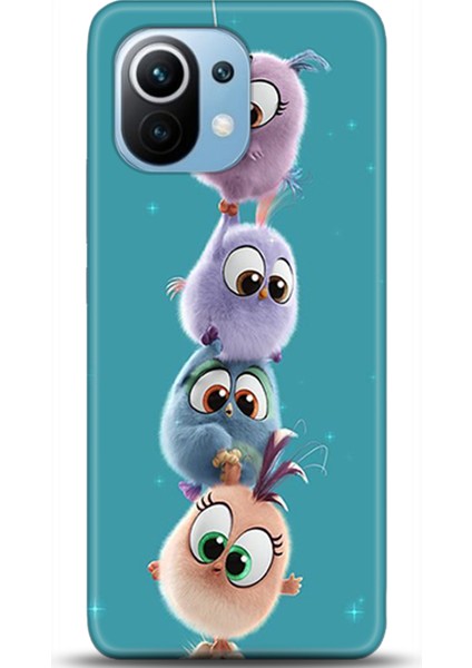 Xiaomi Mi 11 Kılıf Hd Baskılı Kılıf - Followed Institution 0528
