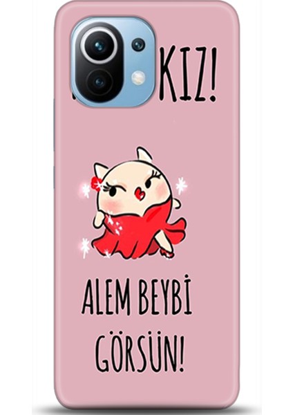 Xiaomi Mi 11 Kılıf Hd Baskılı Kılıf - Followed Institution 0001