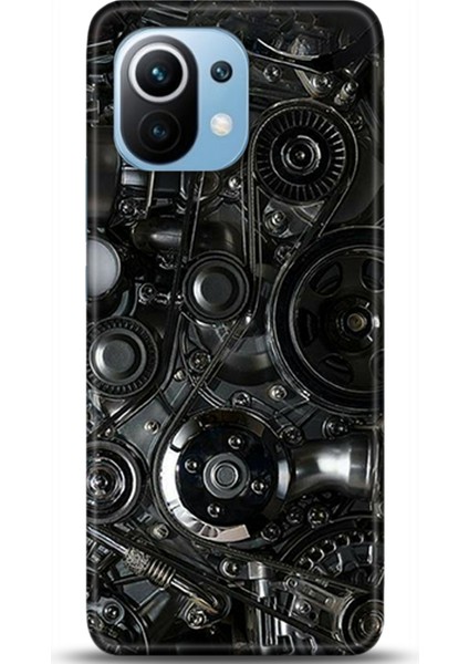 Xiaomi Mi 11 Kılıf Hd Baskılı Kılıf - Followed Institution 0585
