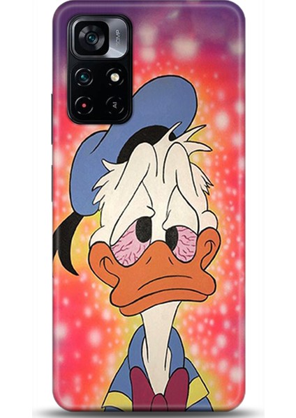Xiaomi Poco M4 Pro 5g Kılıf Hd Baskılı Kılıf - Followed Institution 0288