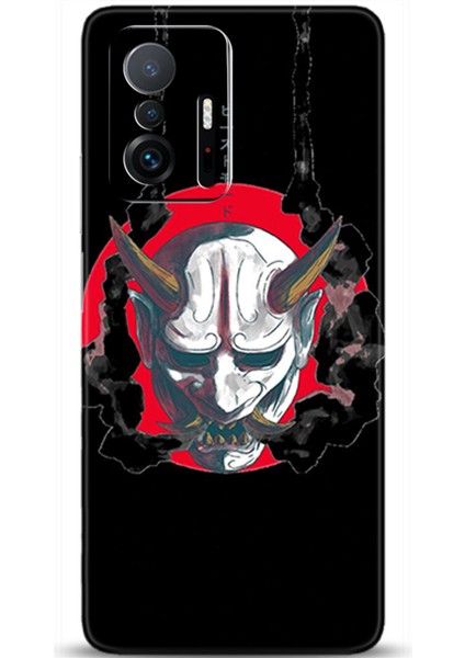 Xiaomi Mi 11T Kılıf Hd Baskılı Kılıf - Followed Institution 0238
