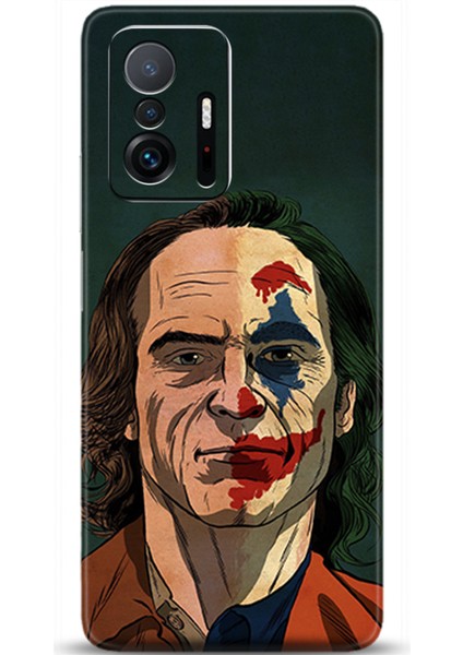 Xiaomi Mi 11T Kılıf Hd Baskılı Kılıf - Followed Institution 0441