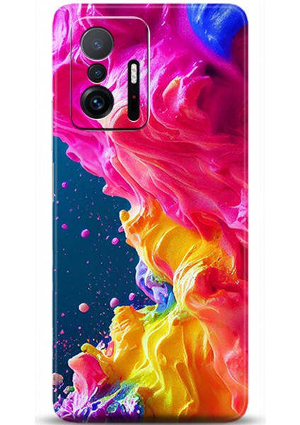 Xiaomi Mi 11T Kılıf Hd Baskılı Kılıf - Followed Institution 0599