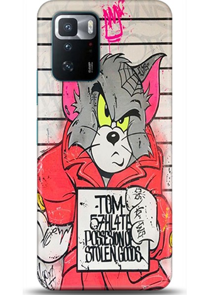 Xiaomi Poco X3 Gt Kılıf Hd Baskılı Kılıf - Followed Institution 0063