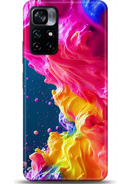 Xiaomi Poco M4 Pro 5g Kılıf Hd Baskılı Kılıf - Followed Institution 0599