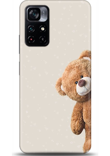 Xiaomi Poco M4 Pro 5g Kılıf Hd Baskılı Kılıf - Followed Institution 0005