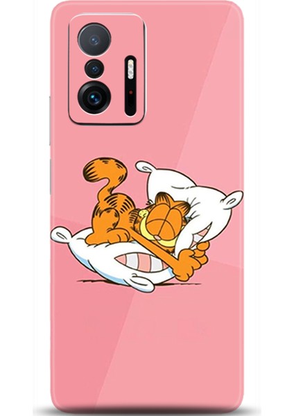 Xiaomi Mi 11T Kılıf Hd Baskılı Kılıf - Followed Institution 0400