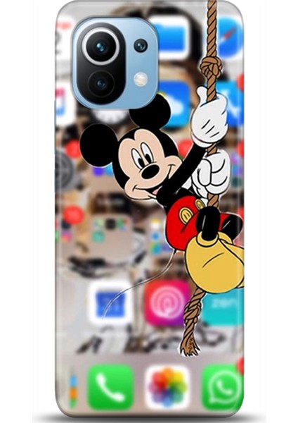 Xiaomi Mi 11 Kılıf Hd Baskılı Kılıf - Followed Institution 0663