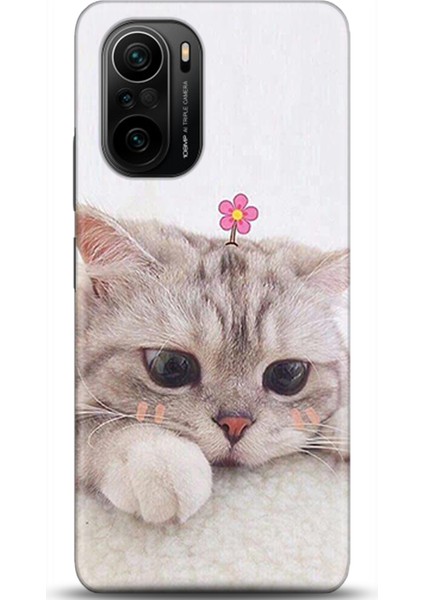 Xiaomi Mi 11i Kılıf Hd Baskılı Kılıf - Followed Institution 0019