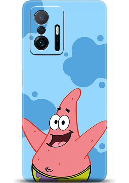 Xiaomi Mi 11T Kılıf Hd Baskılı Kılıf - Followed Institution 0676