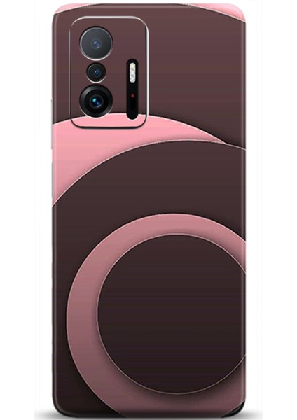 Xiaomi Mi 11T Kılıf Hd Baskılı Kılıf - Followed Institution 0697