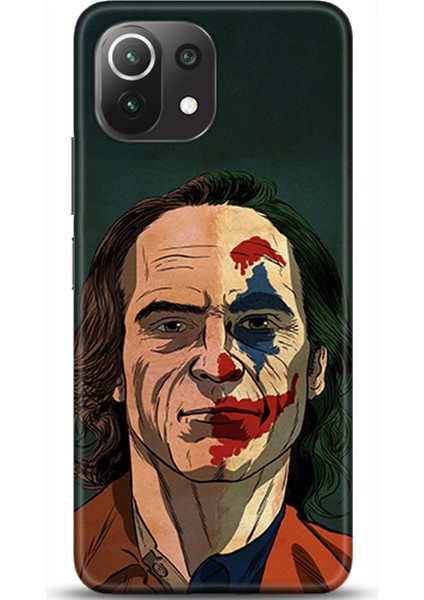 Xiaomi Mi 11 Lite Kılıf Hd Baskılı Kılıf - Followed Institution 0441