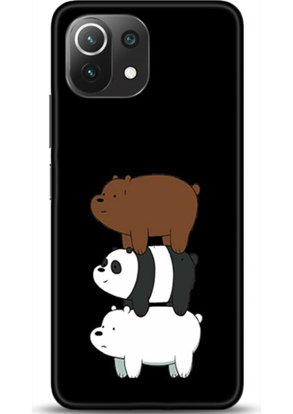 Xiaomi Mi 11 Lite Kılıf Hd Baskılı Kılıf - Followed Institution 0518