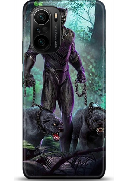 Xiaomi Mi 11i Kılıf Hd Baskılı Kılıf - Followed Institution 0351