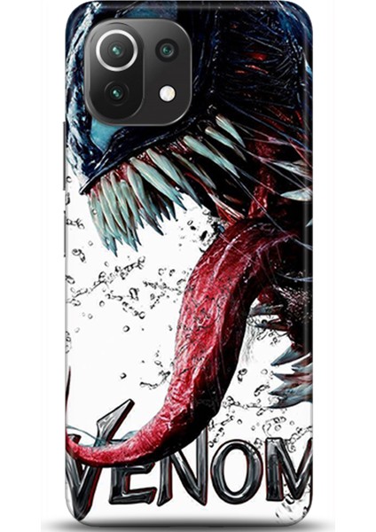 Xiaomi Mi 11 Lite Kılıf Hd Baskılı Kılıf - Followed Institution 0568