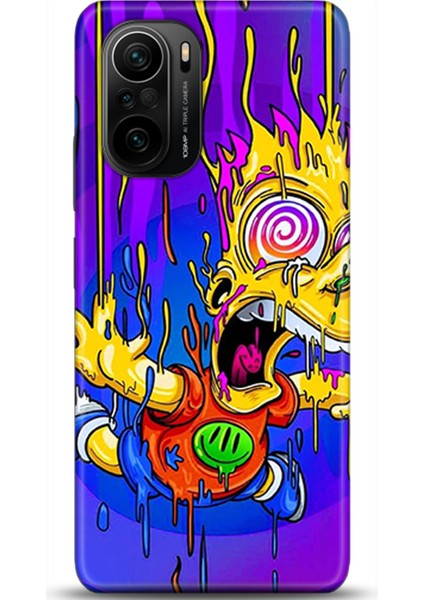 Xiaomi Poco F3 Kılıf Hd Baskılı Kılıf - Followed Institution 0158