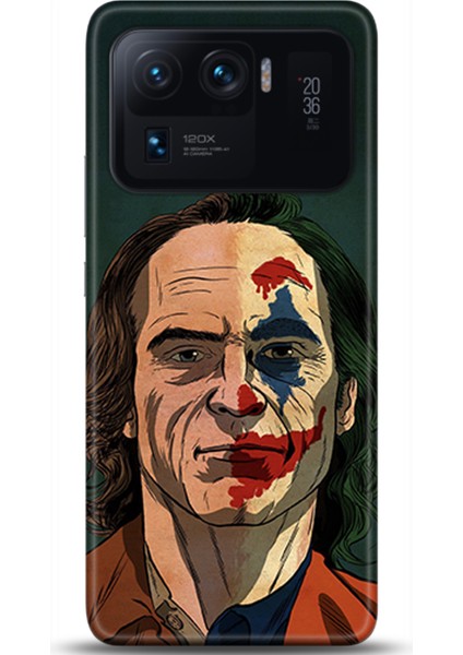 Xiaomi Mi 11 Ultra Kılıf Hd Baskılı Kılıf - Followed Institution 0441