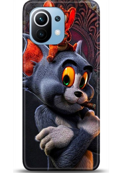 Xiaomi Mi 11 Kılıf Hd Baskılı Kılıf - Followed Institution 0139