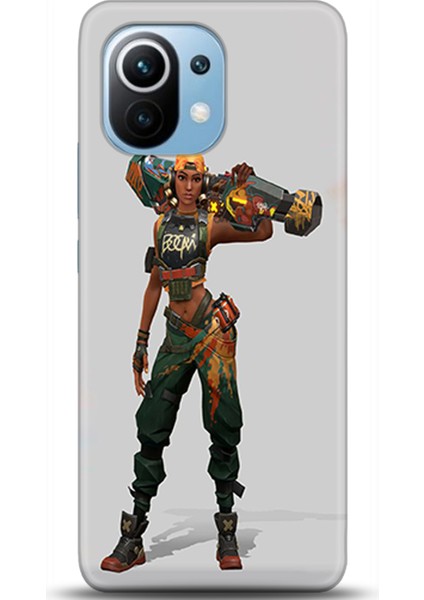 Xiaomi Mi 11 Kılıf Hd Baskılı Kılıf - Followed Institution 0239