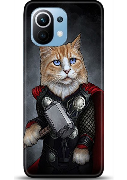 Xiaomi Mi 11 Kılıf Hd Baskılı Kılıf - Followed Institution 0268