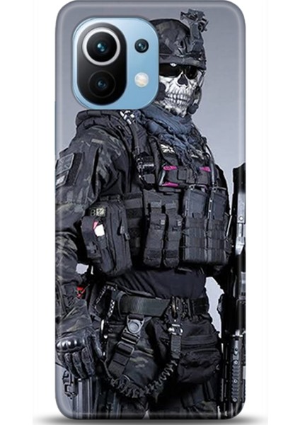 Xiaomi Mi 11 Kılıf Hd Baskılı Kılıf - Followed Institution 0298
