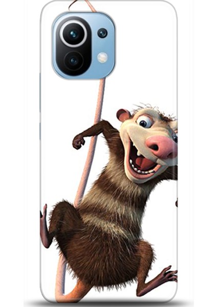 Xiaomi Mi 11 Kılıf Hd Baskılı Kılıf - Followed Institution 0333