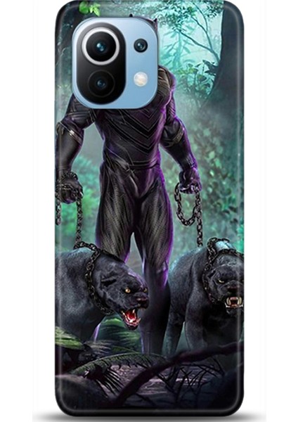 Xiaomi Mi 11 Kılıf Hd Baskılı Kılıf - Followed Institution 0351