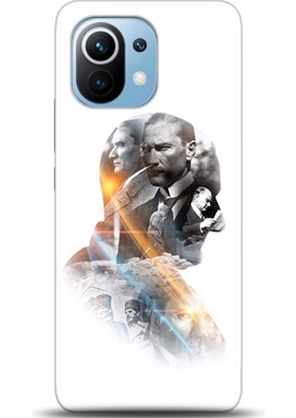 Xiaomi Mi 11 Kılıf Hd Baskılı Kılıf - Followed Institution 0407