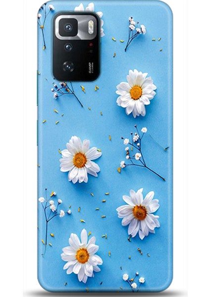 Xiaomi Poco X3 Gt Kılıf Hd Baskılı Kılıf - Followed Institution 0170