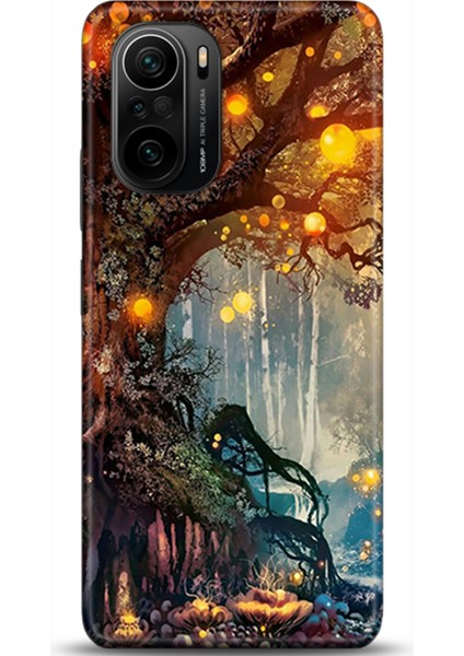 Xiaomi Mi 11i Kılıf Hd Baskılı Kılıf - Followed Institution 0135